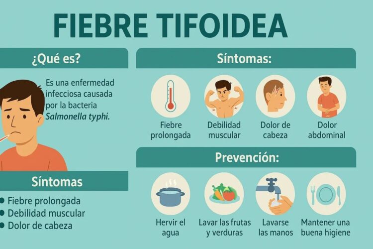 fiebre tifoidea
